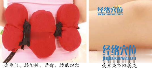 艾灸治療風(fēng)濕