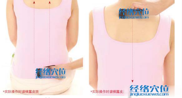 刮痧治療更年期綜合征