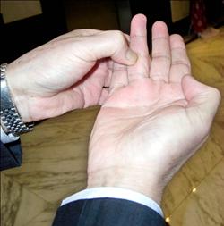 手指肝穴位位置圖