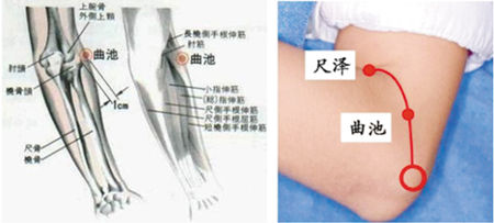 曲池穴的準(zhǔn)確位置圖