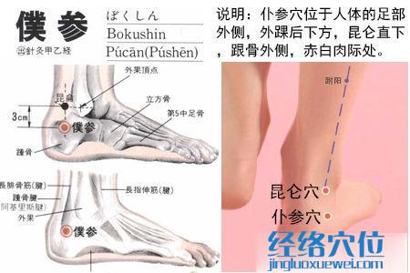 仆參穴位位置圖