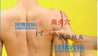 肩貞穴的準(zhǔn)確位置圖