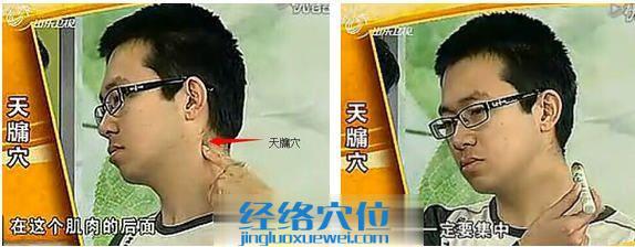 天牖穴的艾灸方法