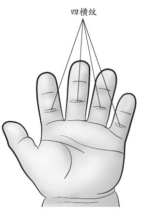 四橫紋（四縫）