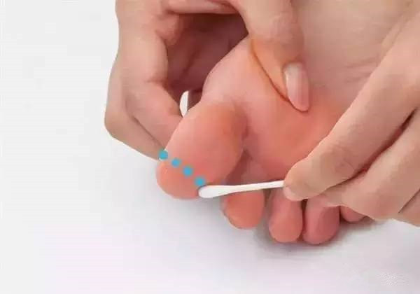 環(huán)軸關(guān)節(jié)