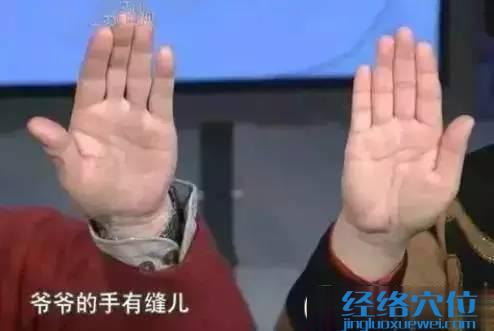 肝臟不好的癥狀