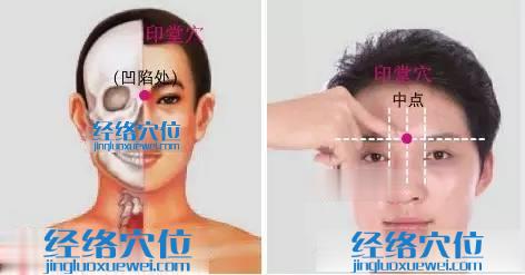 印堂穴的位置圖