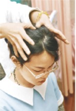 百會穴位位置圖