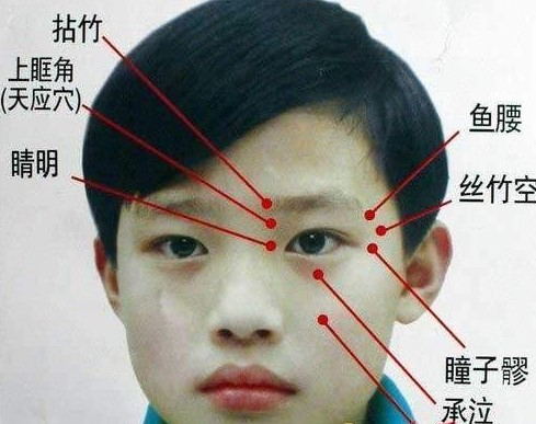 睛明穴位位置圖