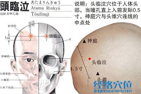 頭臨泣穴的位置圖