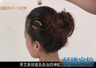 四神聰穴的艾灸方法