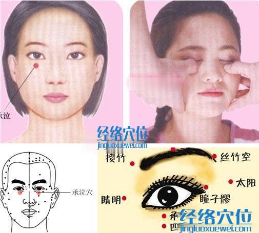 承泣穴位位置圖（高清圖組）