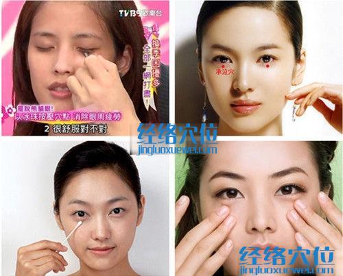 承泣穴的準(zhǔn)確位置圖（高清圖組）