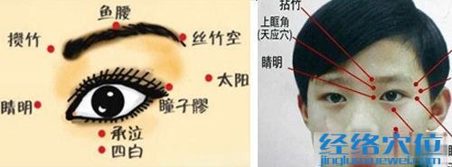 睛明穴的位置圖
