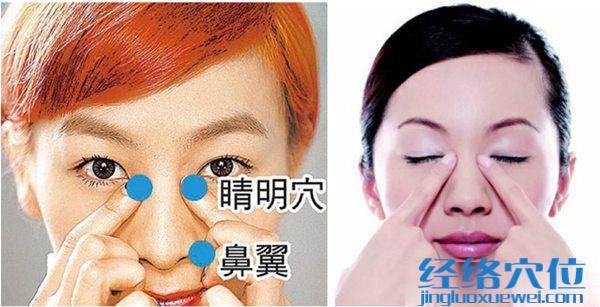睛明穴位圖