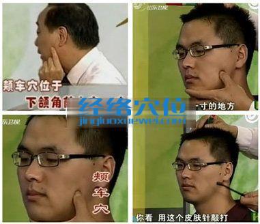 頰車(chē)穴的準(zhǔn)確位置