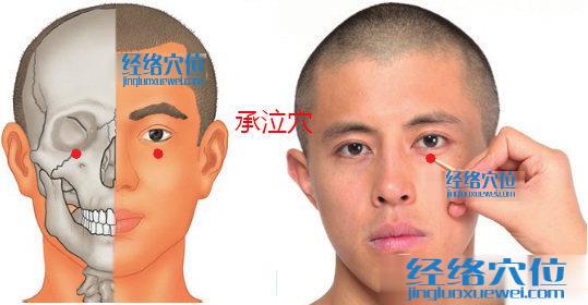 承泣穴位位置圖