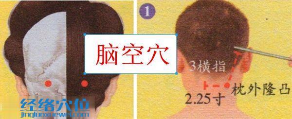 腦空穴的位置及取穴方法示范圖