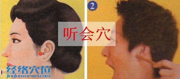 聽(tīng)會(huì)穴的準(zhǔn)確位置圖