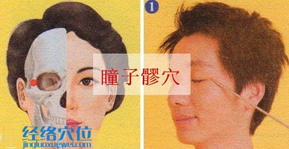 瞳子髎穴位位置圖