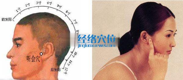 聽(tīng)會(huì)穴位位置圖