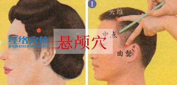 懸顱穴位位置圖