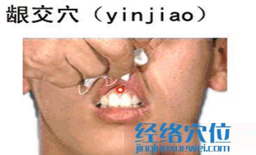 齦交穴的位置圖
