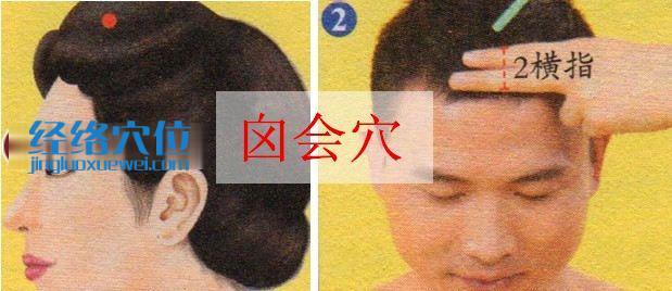 囟會穴位位置圖
