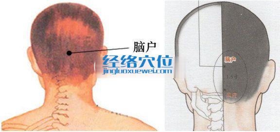 腦戶穴位位置圖