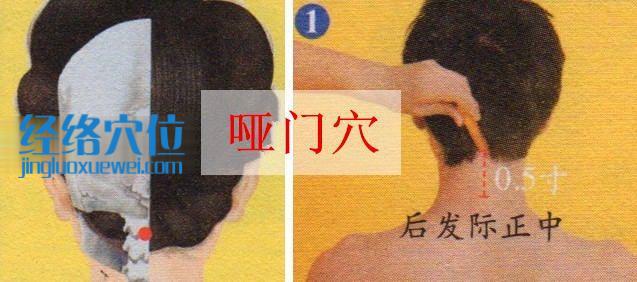 啞門穴位圖
