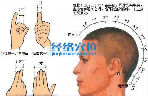 瘈脈穴的位置圖