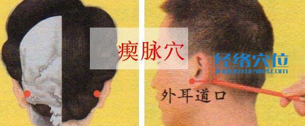 瘈脈穴的準(zhǔn)確位置圖