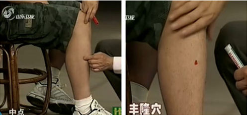 豐隆穴的準(zhǔn)確位置圖