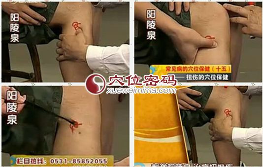 刺激陽陵泉治療扭挫傷