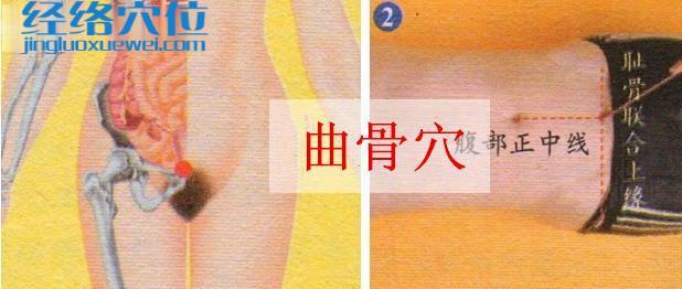 曲骨穴的取穴方法示范圖