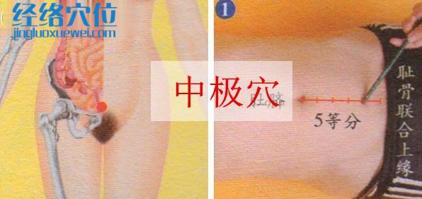 中極穴的快速取穴方法