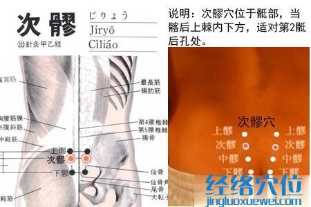 次髎穴位位置圖