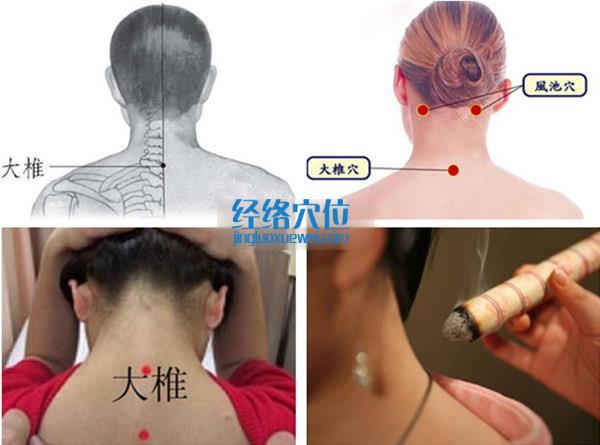 大椎穴的準(zhǔn)確位置圖（高清圖組）