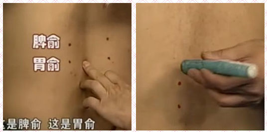 脾俞穴和胃俞穴的位置圖