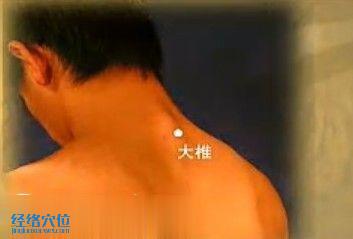 大椎穴的穴位圖及取穴方法
