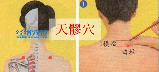 圖解天髎穴的位置