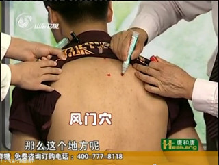 風(fēng)門(mén)穴的位置