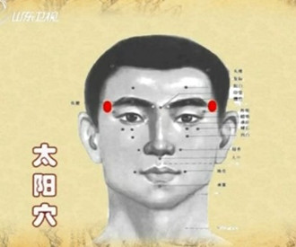治療頭痛的穴位：太陽穴位圖