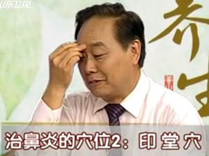 治療鼻炎的穴位：印堂穴的位置圖