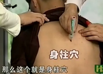 治療咳嗽的第一穴位：身柱穴