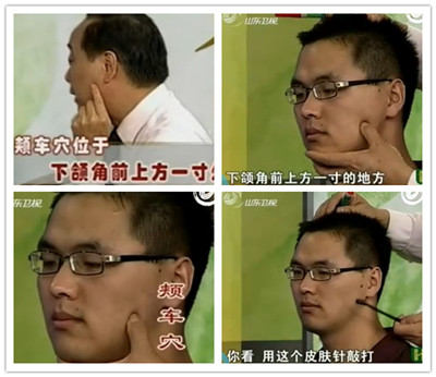 上下牙齒疼痛：頰車穴的位置及操作方法