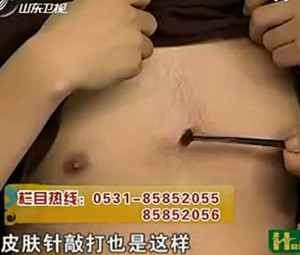 治療心絞痛的穴位：膻中穴