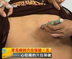 艾灸治療慢性心絞痛