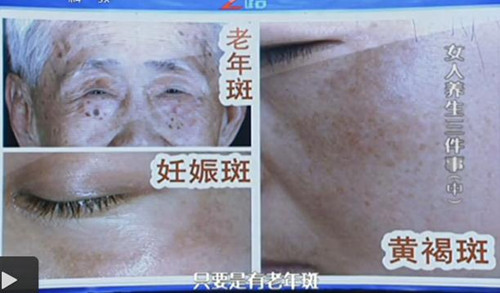 老年人為什么容易長班