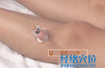 拔罐治療妊娠嘔吐的穴位：足三里穴的拔罐方法